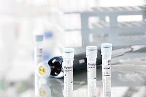 Transfection reagent DOTAP from Biontex