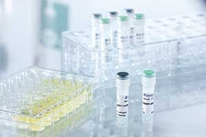 Transfection reagent METAFECTENE® EASY⁺ from Biontex