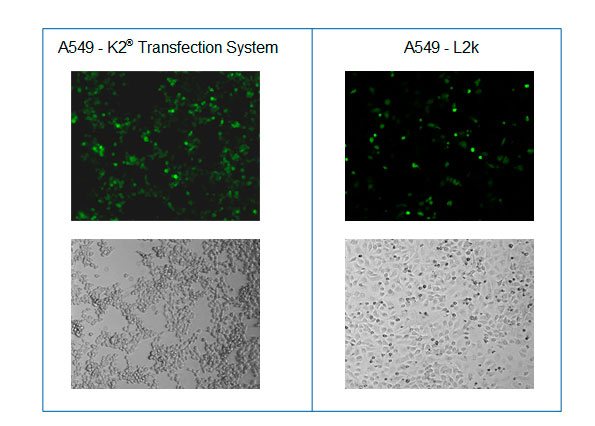 Mikroskopische Aufnahmen nach der Transfektion von A549 Zellen mit dem K2® Transfection System und L2k