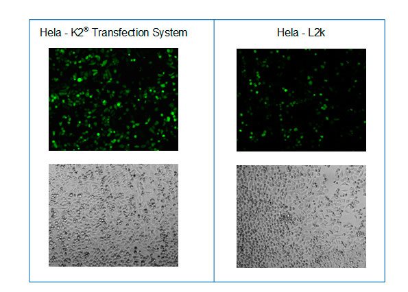 Mikroskopische Aufnahmen nach der Transfektion von HeLa Zellen mit dem K2® Transfection System und L2k