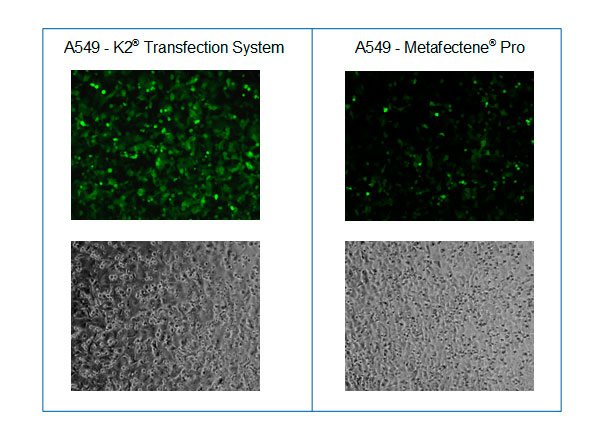 Mikroskopische Aufnahmen nach der Transfektion von A549 Zellen mit GFP codierender mRNA und dem K2® Transfection System im Vergleich zu METAFECTENE® PRO