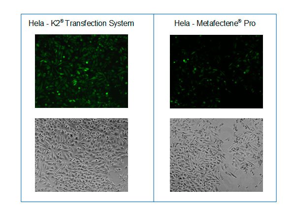 Mikroskopische Aufnahmen nach der Transfektion von HeLa Zellen mit GFP codierender mRNA und dem K2® Transfection System im Vergleich zu METAFECTENE® PRO