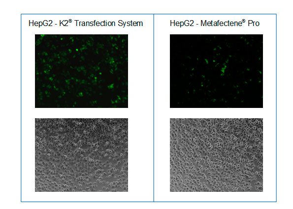 Mikroskopische Aufnahmen nach der Transfektion von HepG2 Zellen mit GFP codierender mRNA und dem K2® Transfection System im Vergleich zu METAFECTENE® PRO