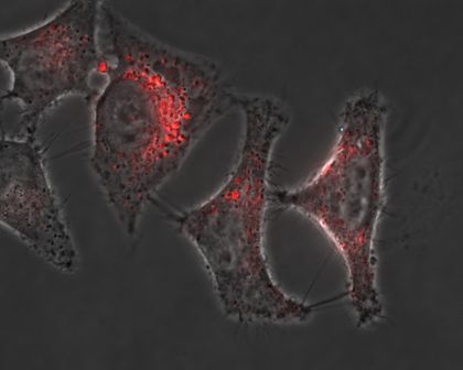 Zellen, die mittels METAFECTENE® FluoR und pCMV-eGFP transfiziert wurden