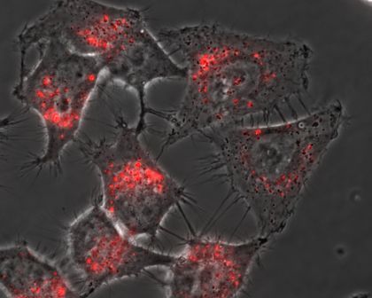 Zellen, die mittels METAFECTENE® FluoR und pCMV-eGFP transfiziert wurden