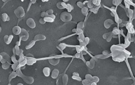 Elektronenmikroskopische Aufnahme einer Mykoplasmen-Kolonie auf einer Zelloberfläche
