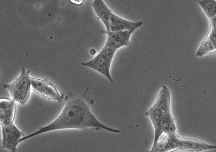 Lichtbild nach der Proteofektion von HeLa Zellen mit GST-NLS-GFP Protein