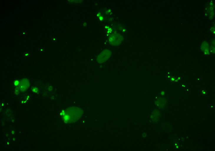 Fluoreszenzbild nach der Proteofektion von HeLa Zellen mit GST-NLS-GFP Protein