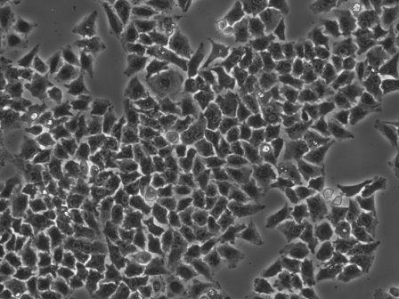 Lichtbild nach der Proteofektion von HepG2 Zellen mit R-Phycoerythrin